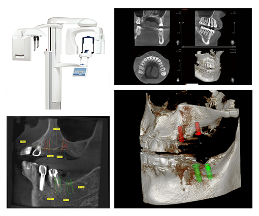 最新式の歯科用CT（Prevista Uni-3D）を導入しています