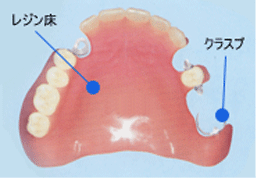 クラスプタイプ