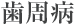 歯周病 歯周病