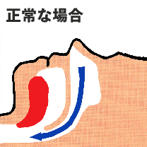 治療法