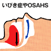 治療法 治療法