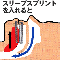 治療法 治療法