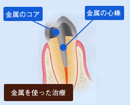 ファイバーコア