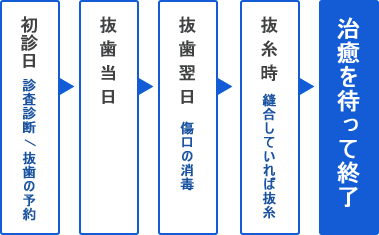 抜歯治療の流れ 抜歯治療の流れ